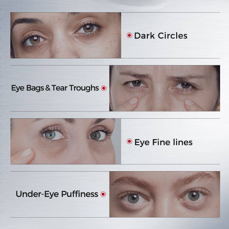くま用アイパッチ – コラーゲン、アセチルヘキサペプチド-8 - Eye Pad Collagen のレビューと価格